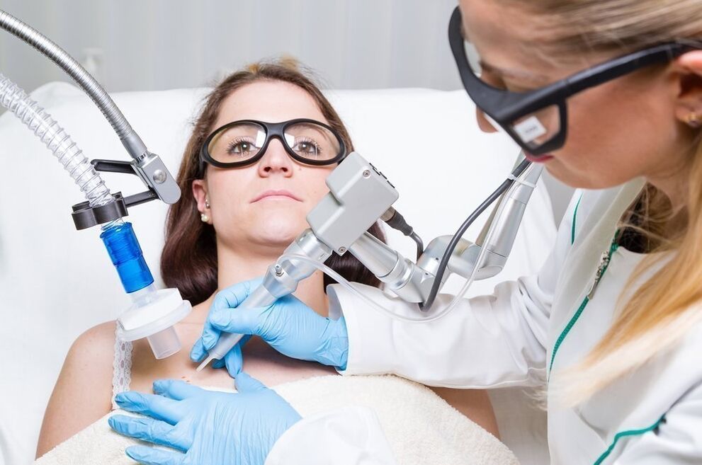 Treatment of warts